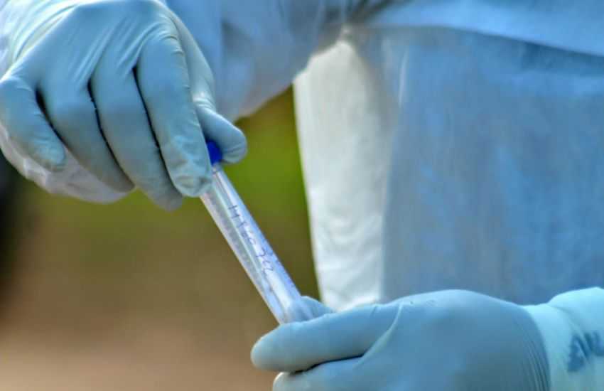 COVID-19: Nuevo reporte epidemiológico