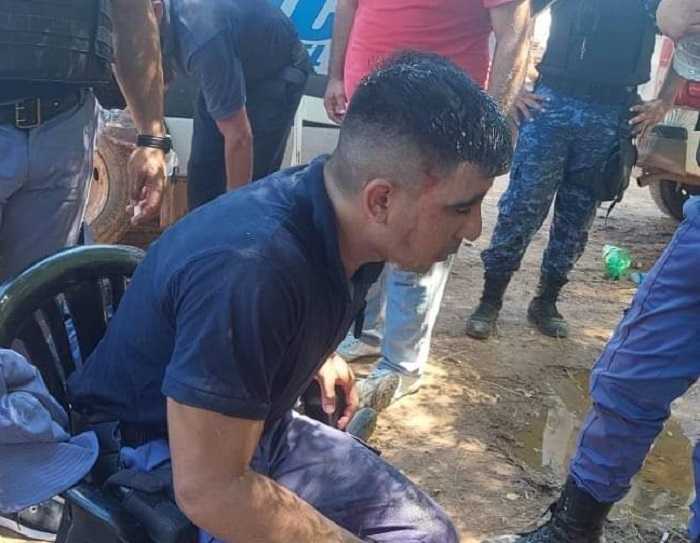 Operarán a cabo de la Policía del Chaco herido con un proyectil en uno de sus ojos