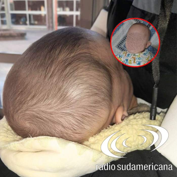 Denunció que dejó a su bebé con la niñera y lo encontró con fractura de cráneo