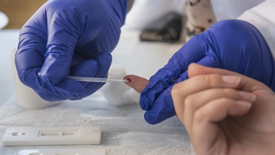 Brasil: al menos seis personas contrajeron VIH tras recibir trasplantes de órganos infectados