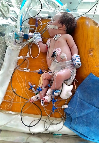 Una beba misionera con cardiopatía congénita lucha por su vida en Buenos Aires: sus padres organizaron una rifa solidaria para solventar los gastos