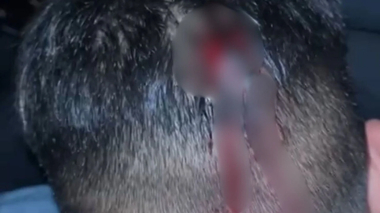 Violenta patota atacó a dos jóvenes a la salida de una fiesta en La Plata