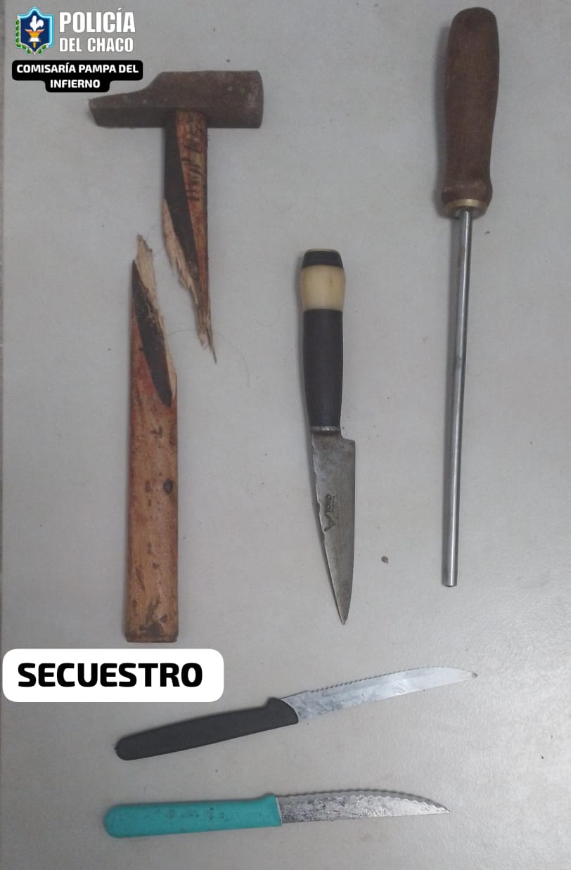 Violencia de género: hombre lesionado tras atacar a su pareja