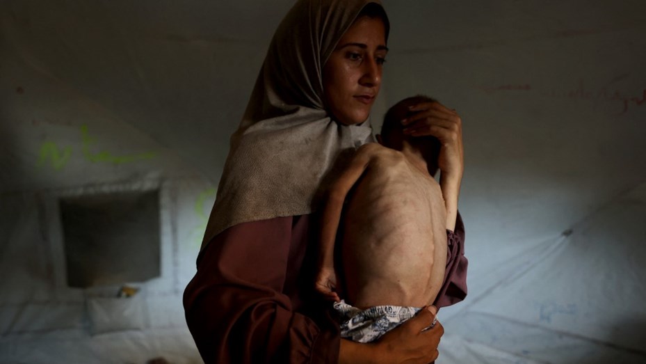 «Hambre masiva»: organizaciones humanitarias alertan sobre la desnutrición infantil en Gaza