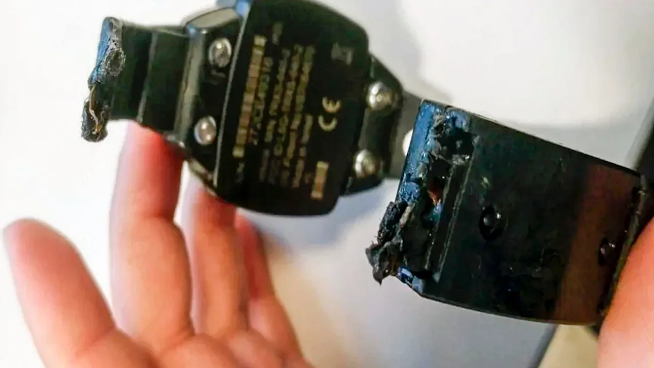 Río Negro: un joven fue imputado por cortarse la tobillera electrónica