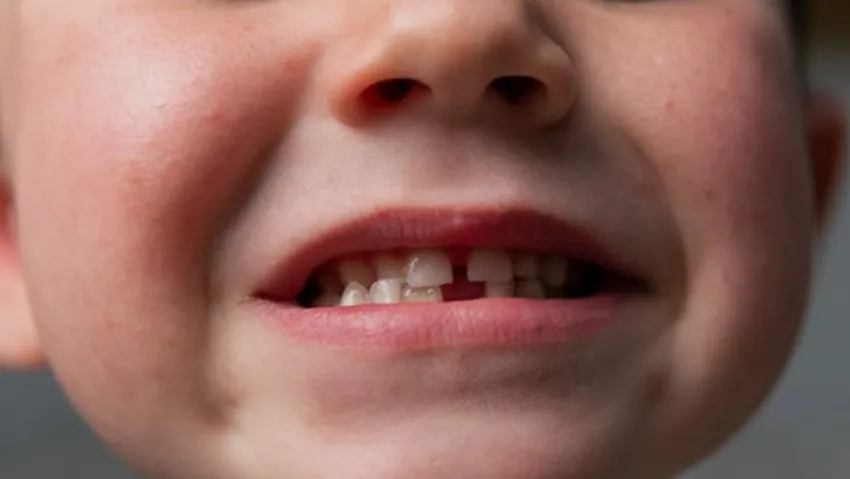 Madre le dio cocaína a su hijo de 4 años por dolor de muelas: 7 años de prisión